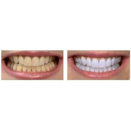 Eva Cosmetics Whitening Pen