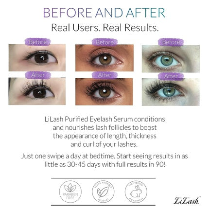 LiLash Purified Eyelash Physician-Formulated Serum for Fuller and Longer Looking Eyelashes 90-Day Supply 2mL