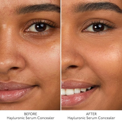 By Terry Hyaluronic Serum Concealer Radiant & Hydrating Skincare-Infused