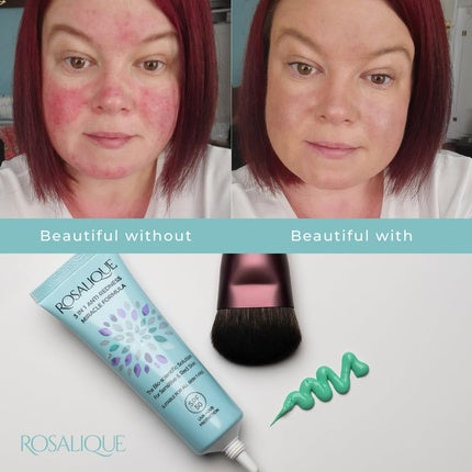 Rosalique 3 in 1 Anti-Redness Miracle Formula Colour Corrector SPF50 for Hypersensitive and Redness Prone Skin 30ml