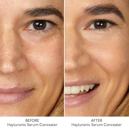 By Terry Hyaluronic Serum Concealer Radiant & Hydrating Skincare-Infused