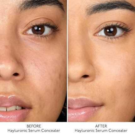 By Terry Hyaluronic Serum Concealer Radiant & Hydrating Skincare-Infused
