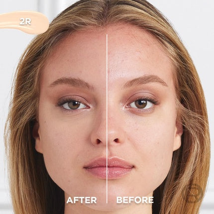 L'Oréal Paris Serum Concealer Medium Coverage Radiant Finish with 1.5% Hyaluronic Acid and Caffeine True Match 10ml
